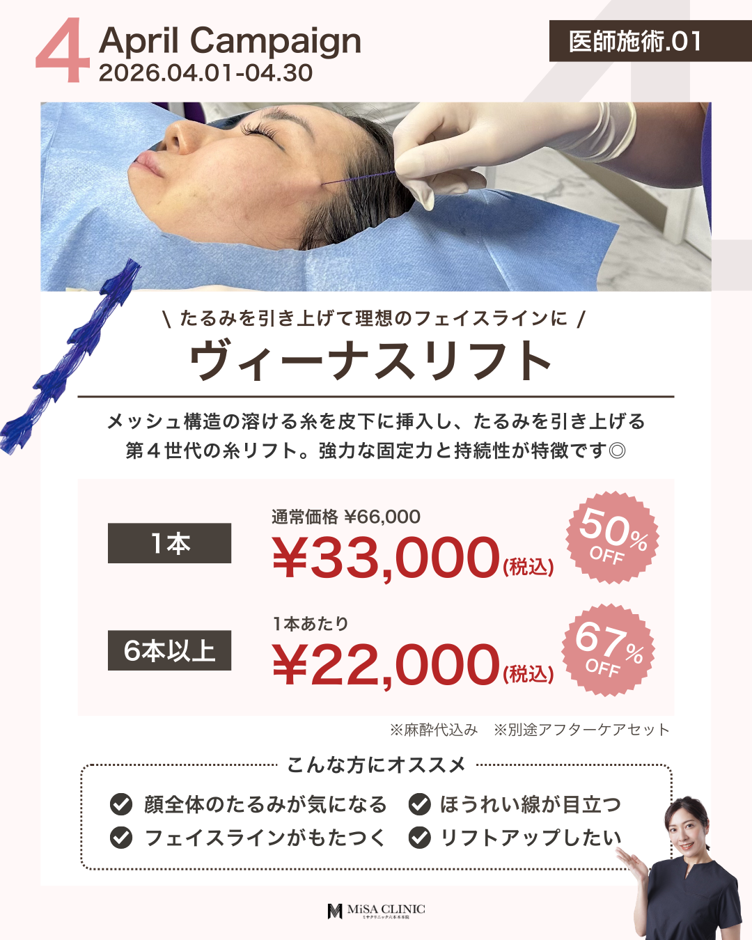 4月キャンペーン［医師施術］糸リフト（ヴィーナスリフト）