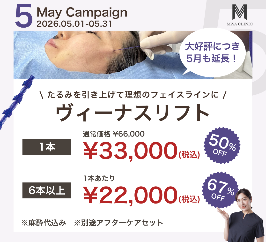 5月キャンペーン［医師施術］糸リフト（ヴィーナスリフト）