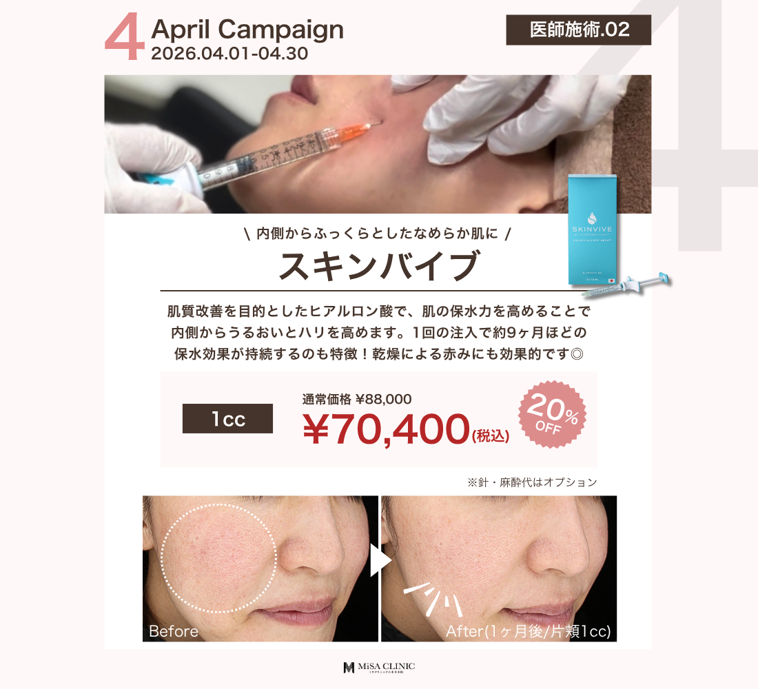 4月キャンペーン［医師施術］スキンバイブ（ボライト）　
