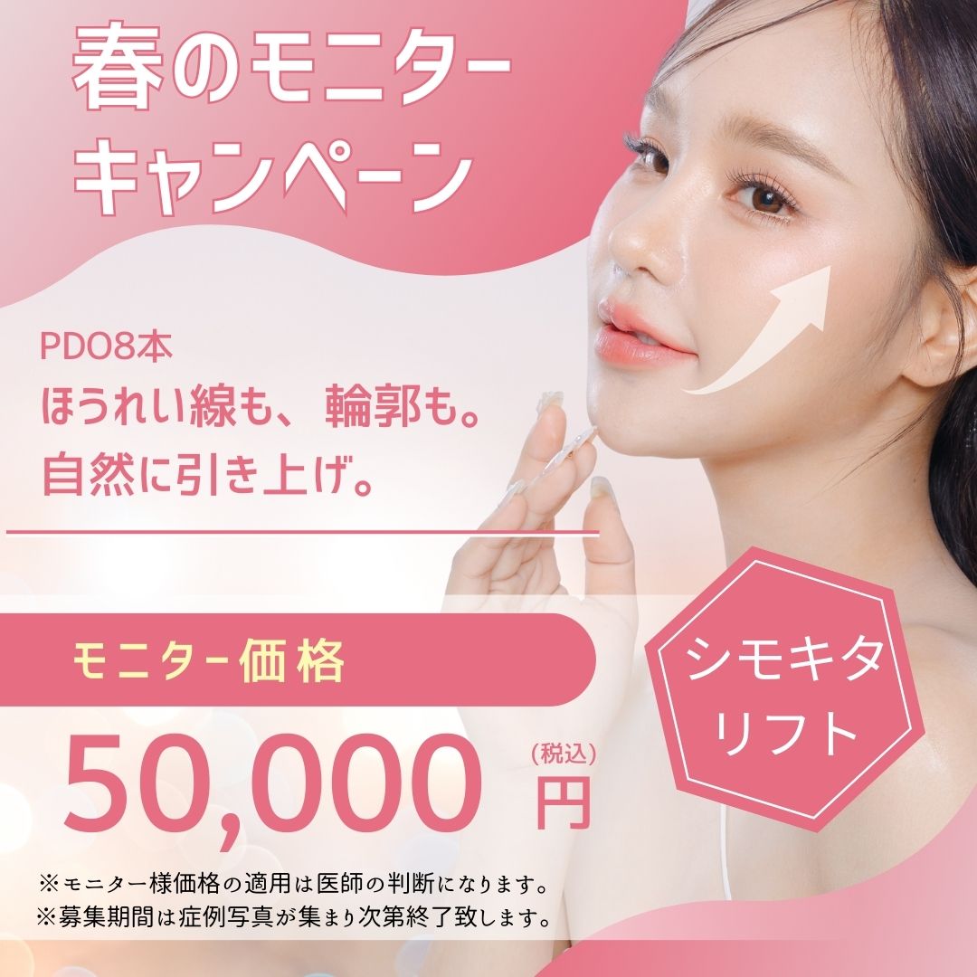 【当日施術】春のモニターキャンペーン・シモキタリフト(糸PDO8本)