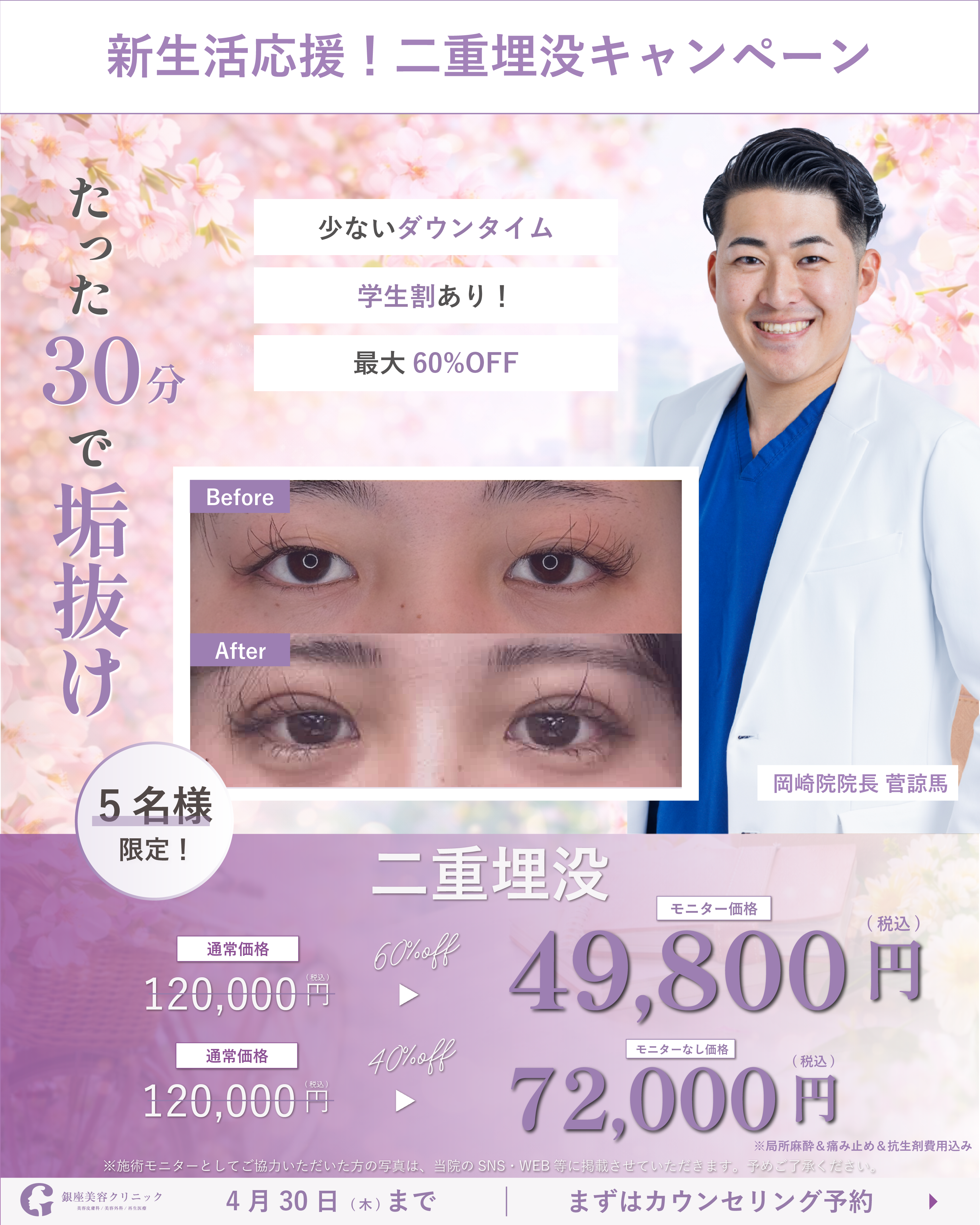 二重埋没【￥49,800〜】相談のみ