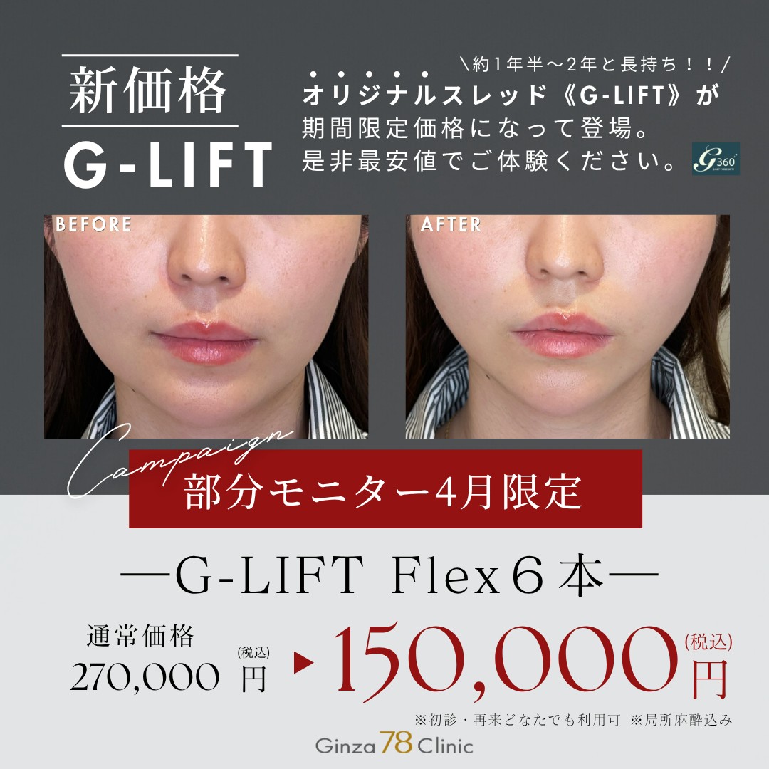 <4月>G-LIFT flex6本　￥150,000